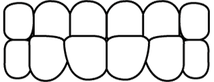受け口