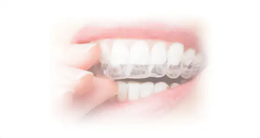 マウスピース矯正にも対応