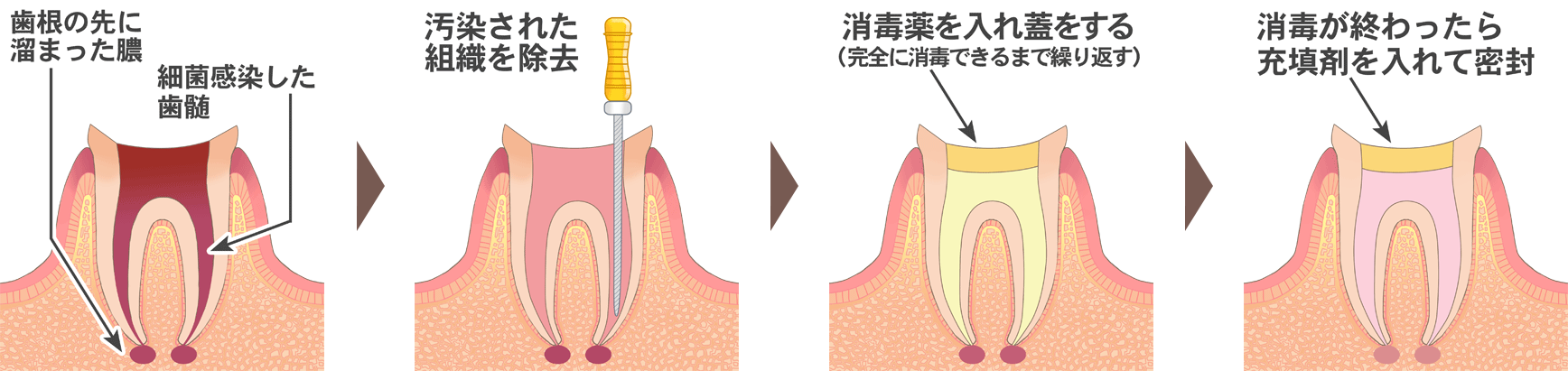 治療⽅法