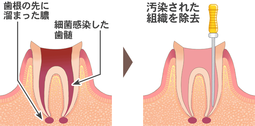 治療⽅法