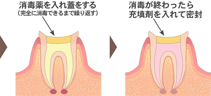 治療⽅法